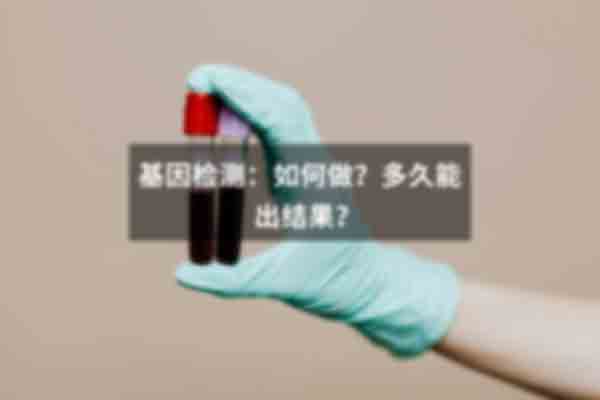 太原小店区上户口亲子鉴定头发可以做吗